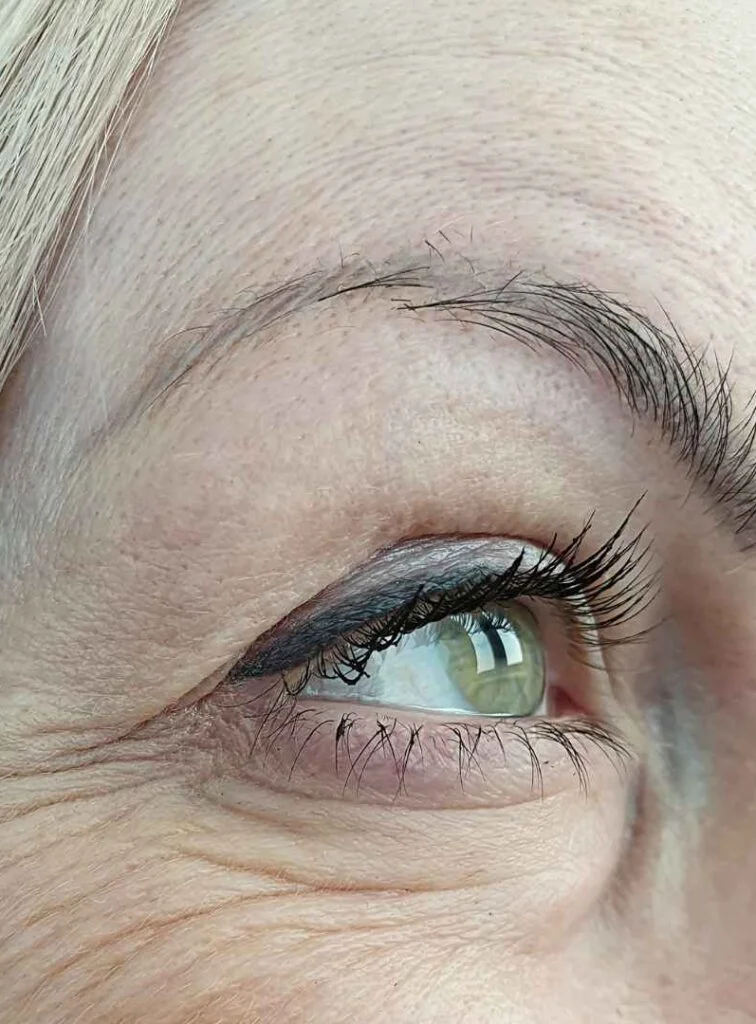 Candidatos para Blefaroplastia