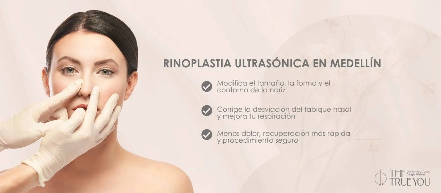 Resultado Rinoplastia