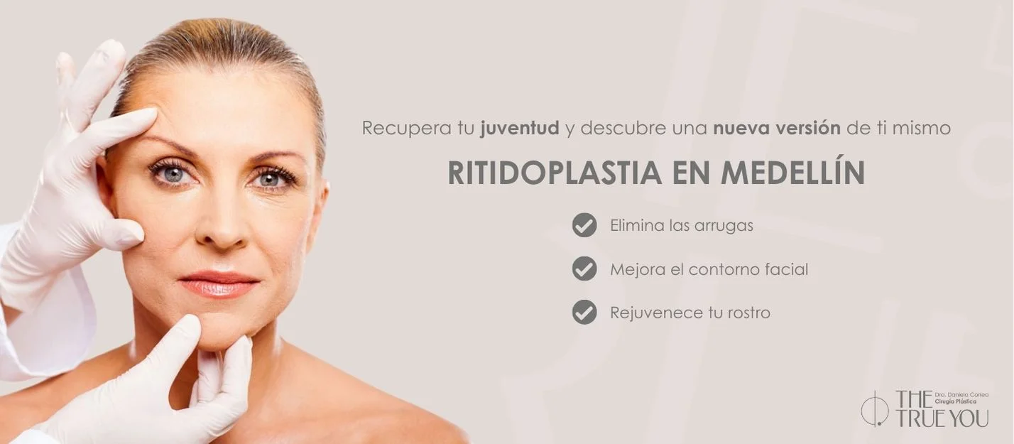 Resultado Rinoplastia
