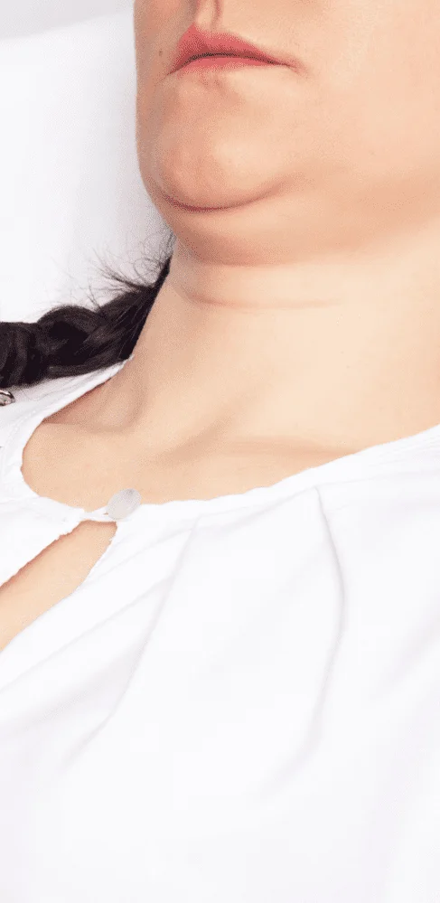 Lipopapada
